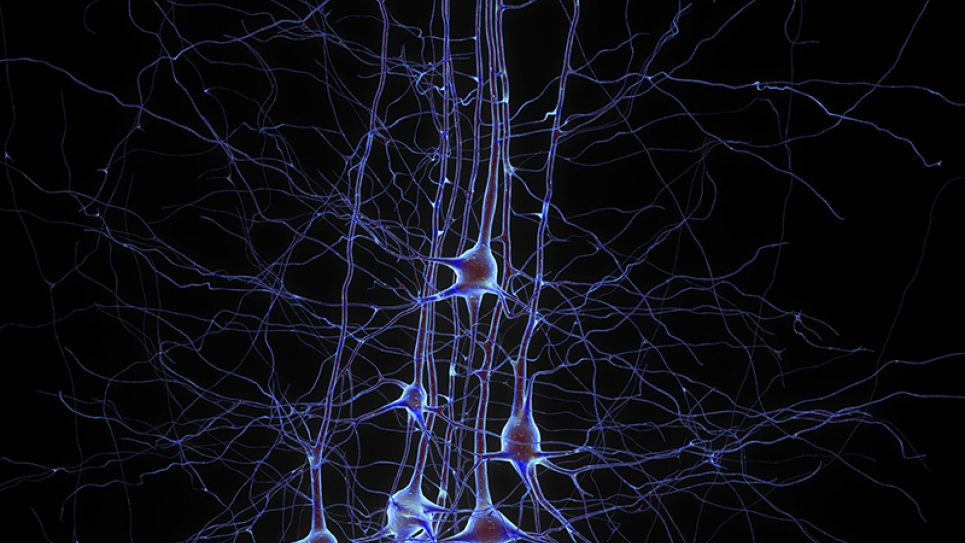 Digital reconstruction of pyramidal cells Digital reconstruction of pyramidal cells